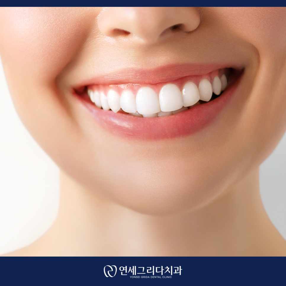 염창동치아미백, 자연스러운 결과를 원한다면 관련 이미지 6