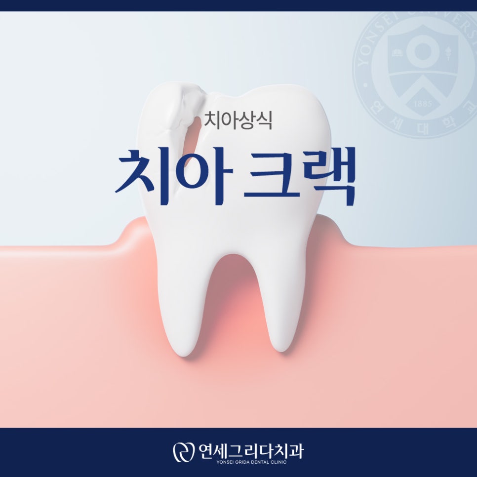 치아 크랙 씹을 때마다 통증이 생긴다면 관련 이미지 1