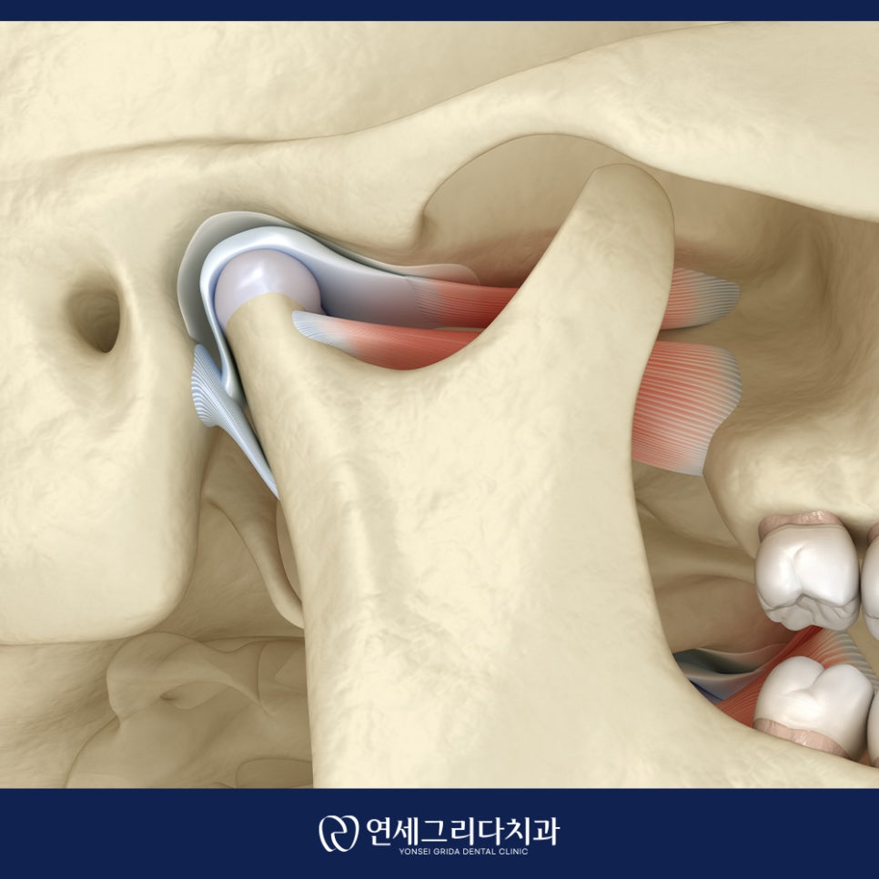 턱관절 통증 입을 벌릴 때 아픈 이유는? 관련 이미지 4