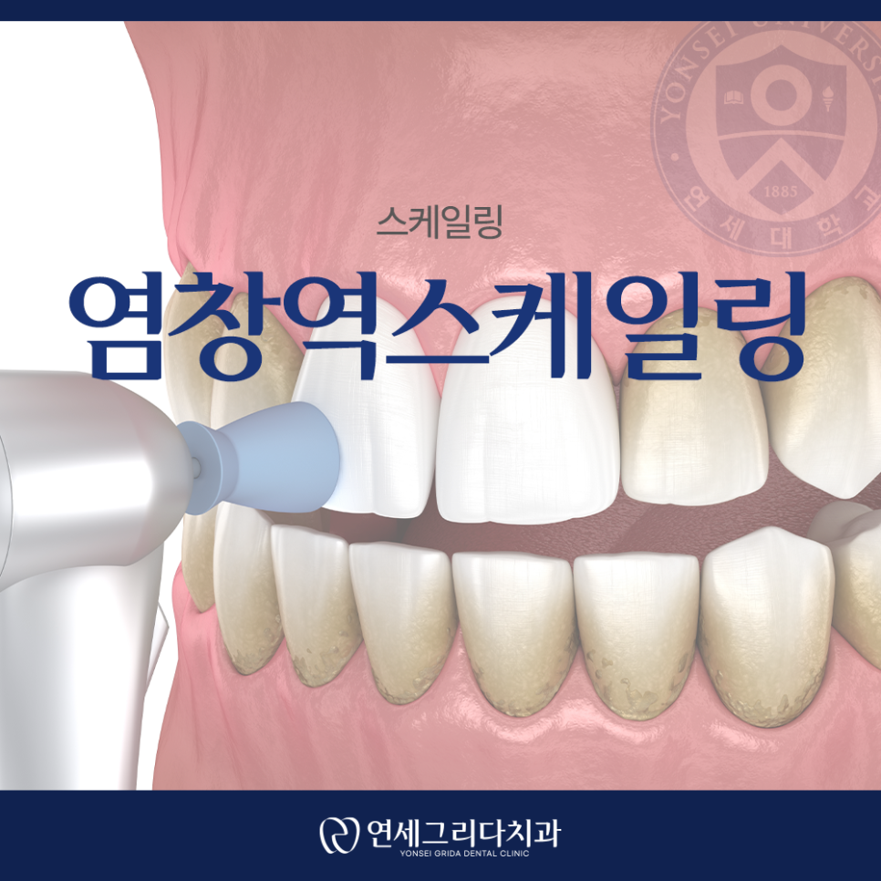 염창역스케일링, 피가 나는데 괜찮을까요? 관련 이미지 1