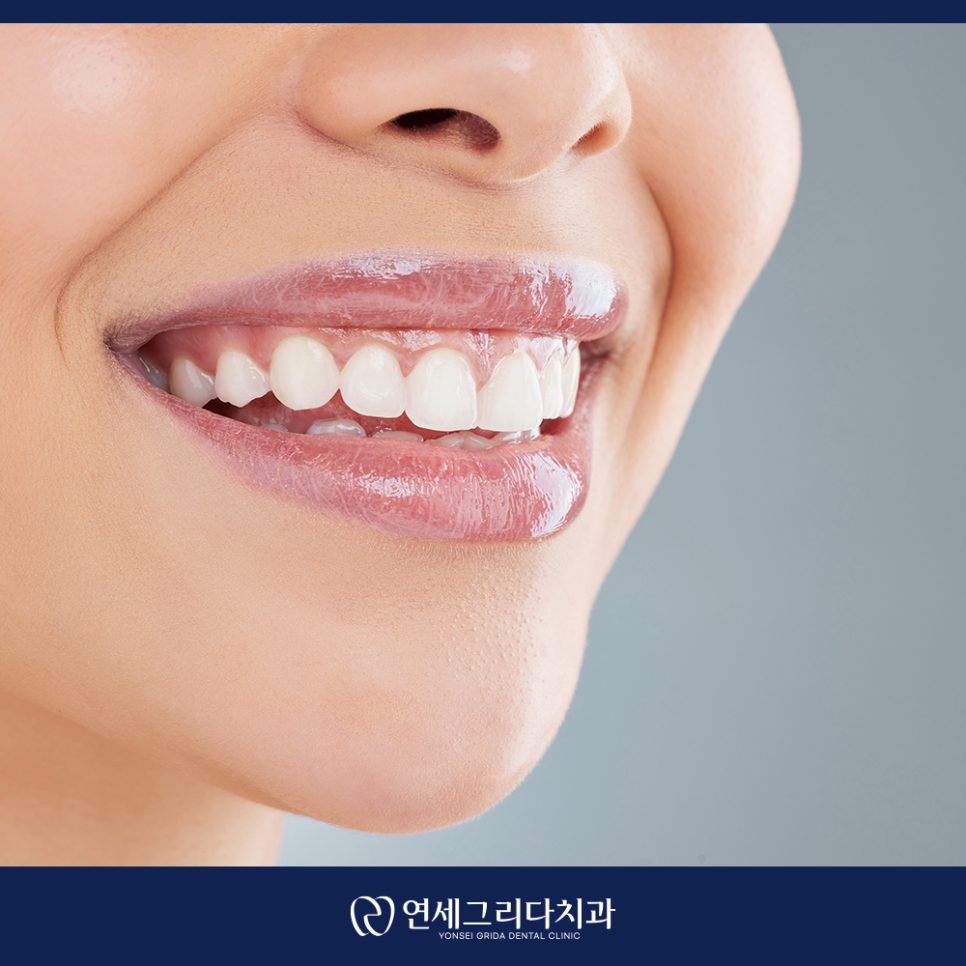 불소도포, 건강한 치아를 위한 선택 관련 이미지 5