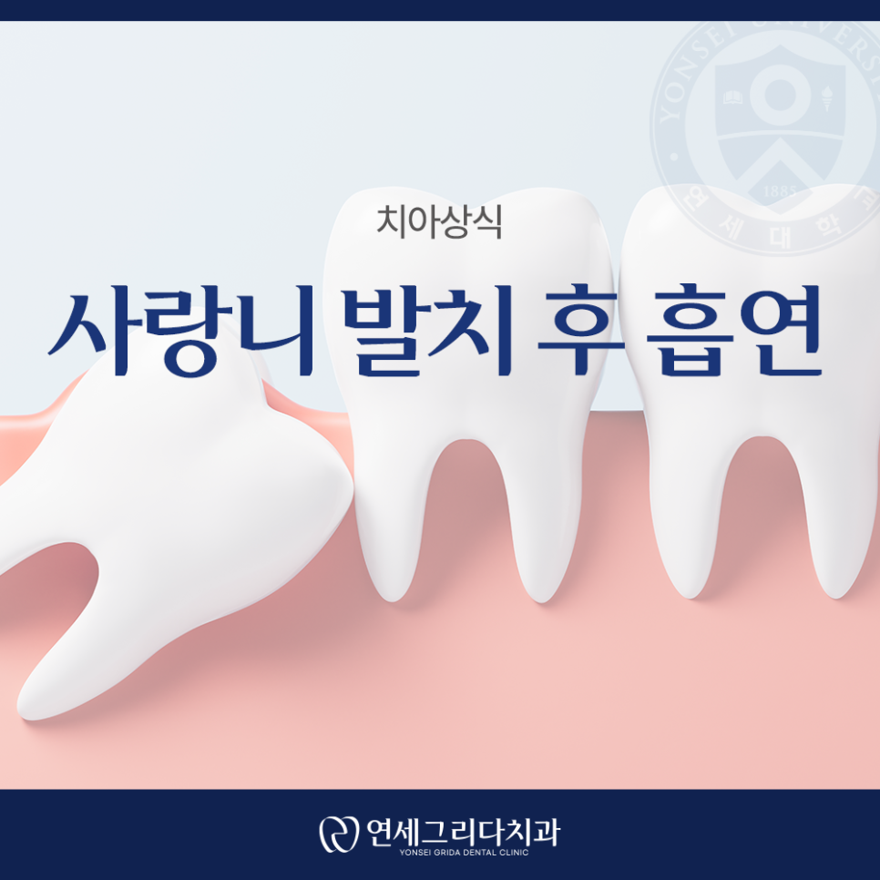사랑니 발치 후 흡연, 꼭 알아야 할 주의사항 관련 이미지 1