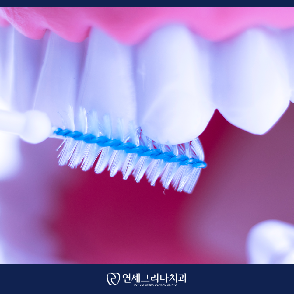 치간칫솔 사용법, 제대로 알고 쓰면 달라집니다! 관련 이미지 5