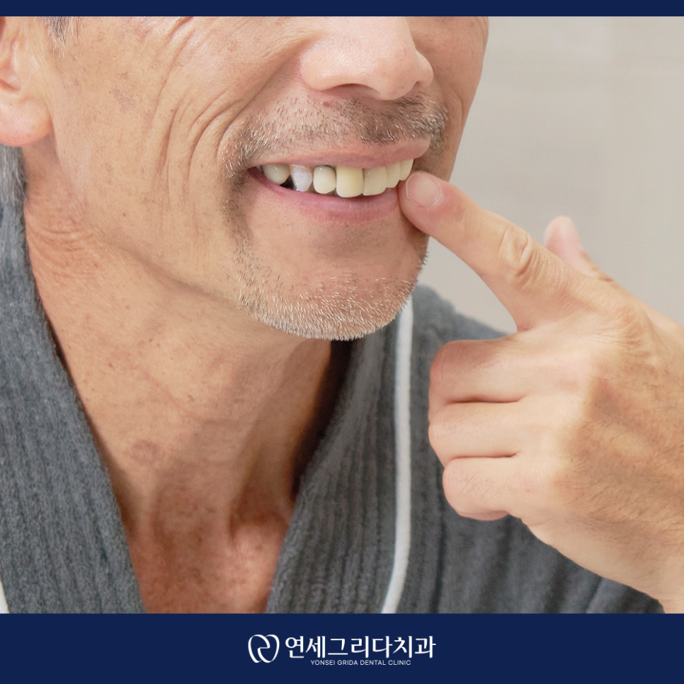 염창역치과, 임플란트 식립 후 흔들리는 느낌이 든다면? 관련 이미지 5