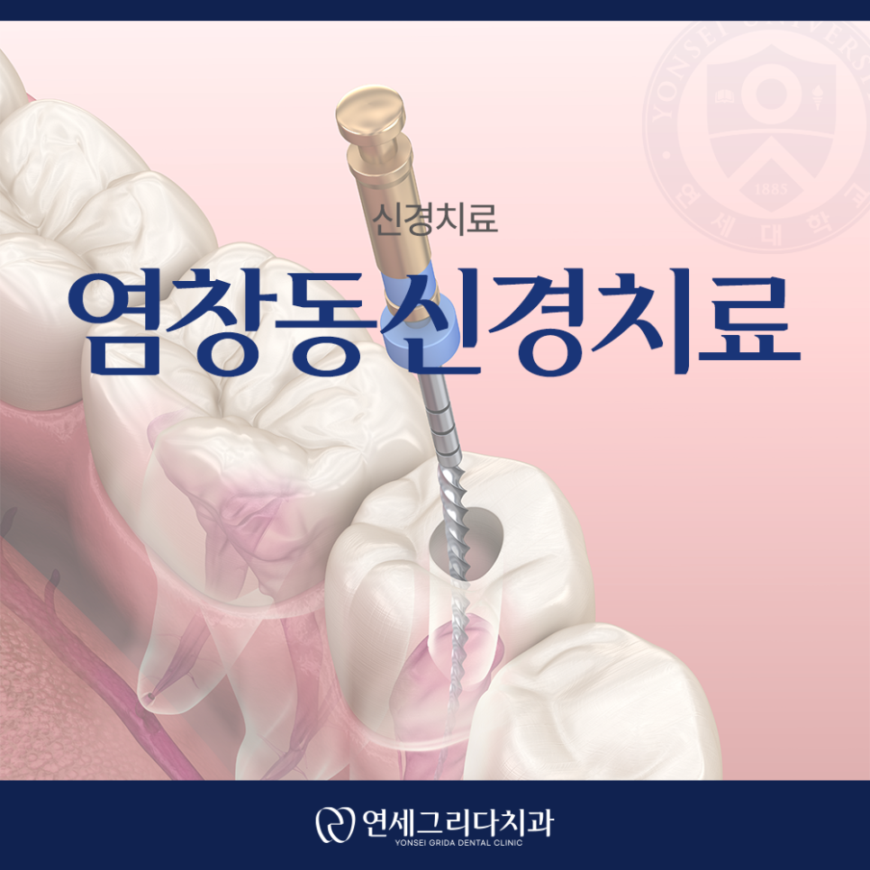 염창동신경치료, 치아를 오래 사용하기 위해 관련 이미지 1