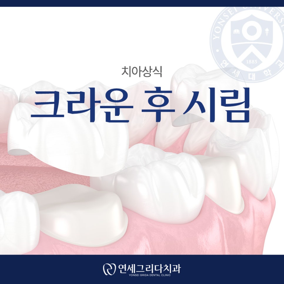 크라운 후 시림 계속 지속된다면? 관련 이미지 1