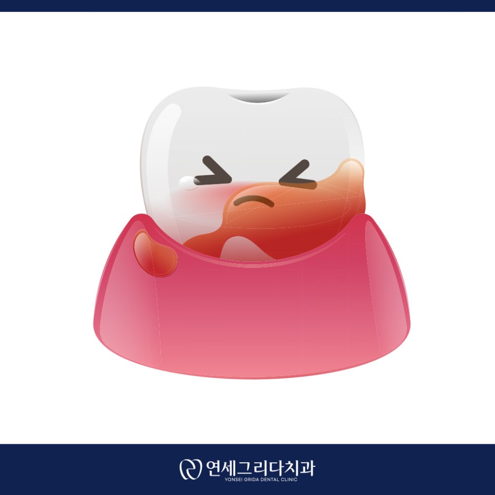 치간칫솔 사이즈 어떻게 골라야 할까요? 관련 이미지 5