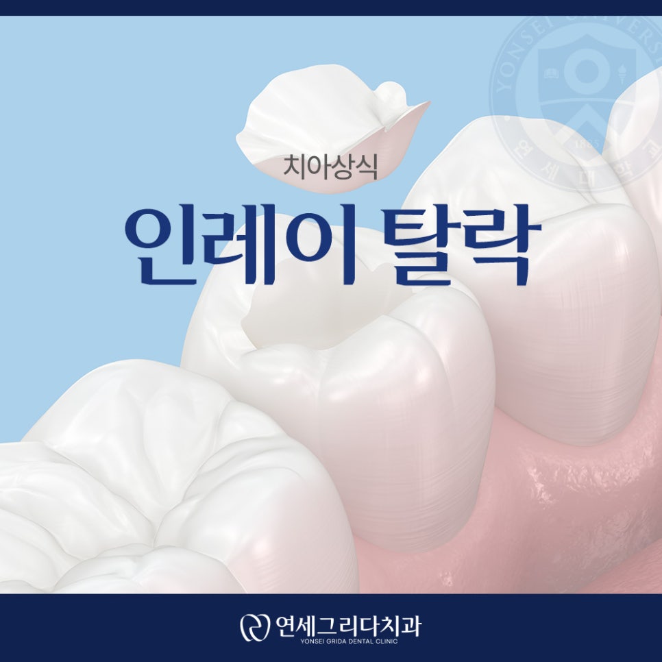 인레이 탈락 재부착이 가능할까요? 관련 이미지 1