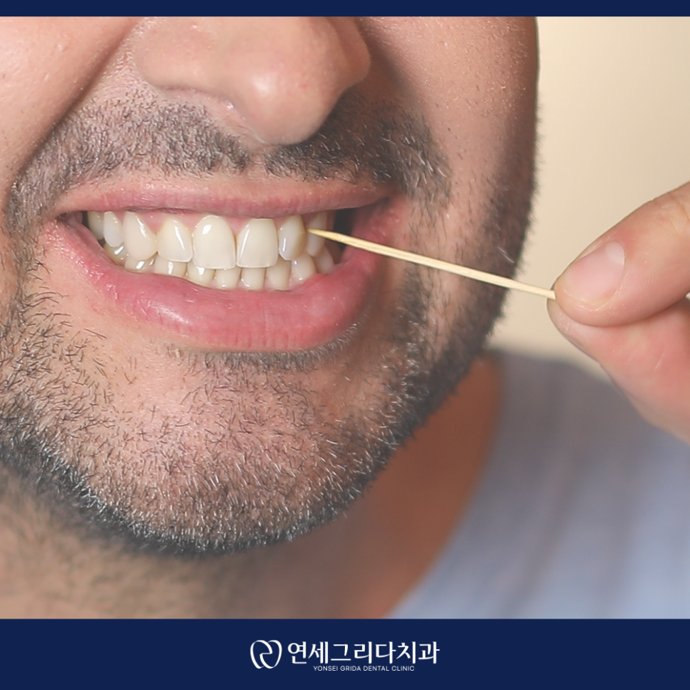 이쑤시개 사용, 치아 사이 음식물 뺄 때 괜찮을까요? 관련 이미지 2