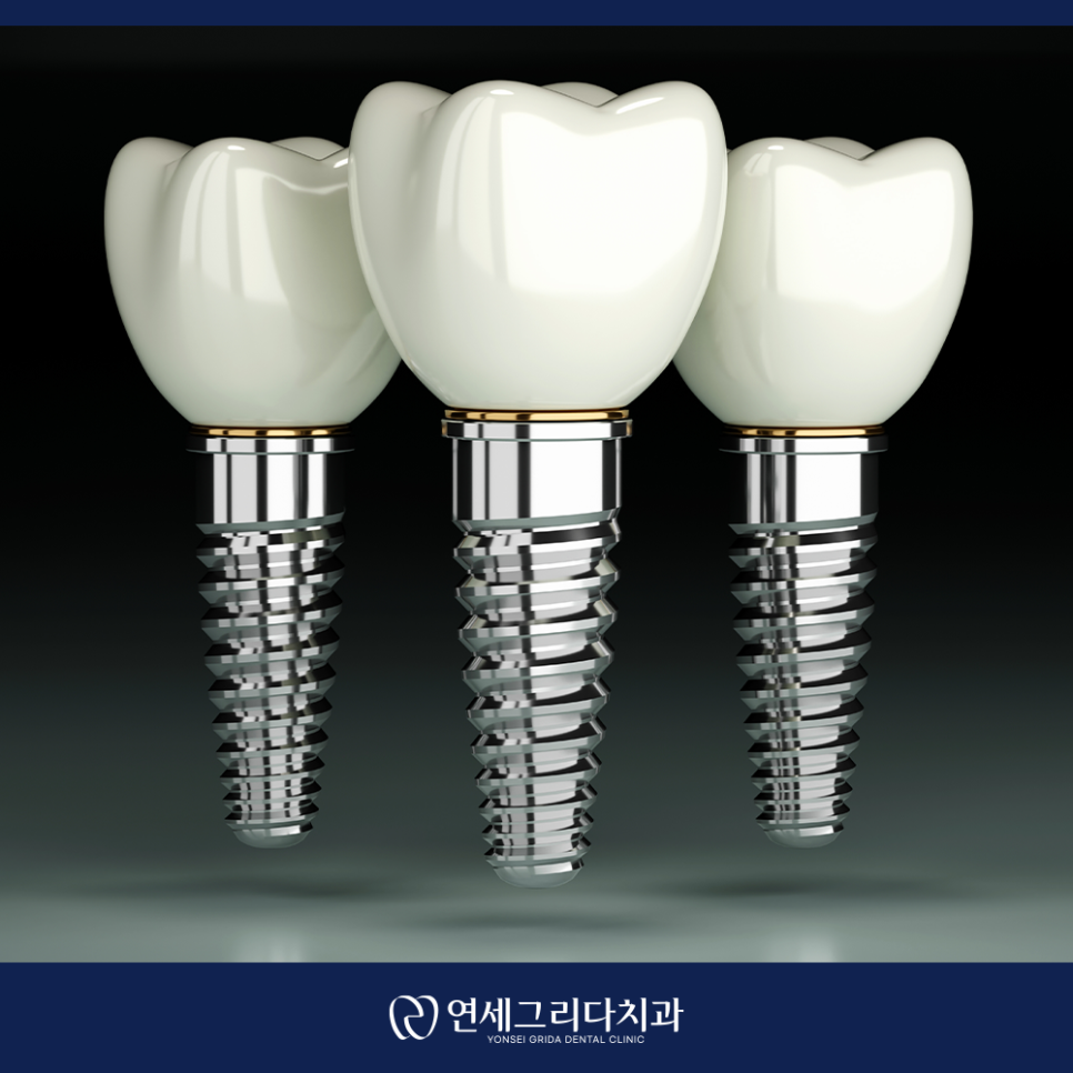 Deungchon Station Dental Implants: How to Use Them for as Long as Natural Teeth image 2