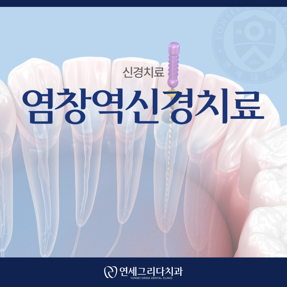 Yeomchang Station Root Canal Treatment: Addressing the Cause of Pain First image 1