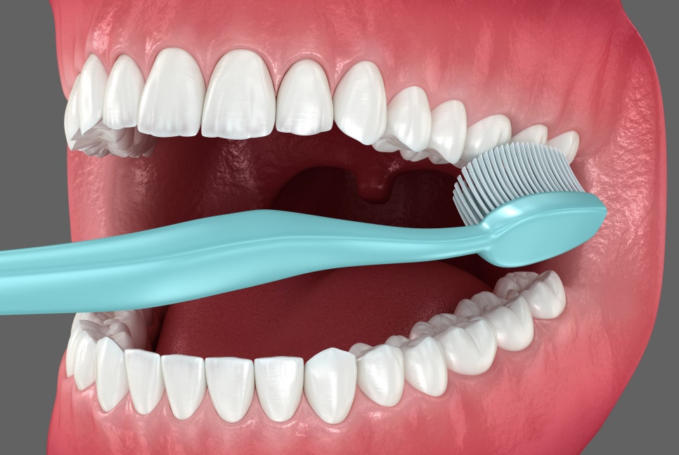 잇몸 부음, 치료 시기를 놓치지 않으려면 관련 이미지 5