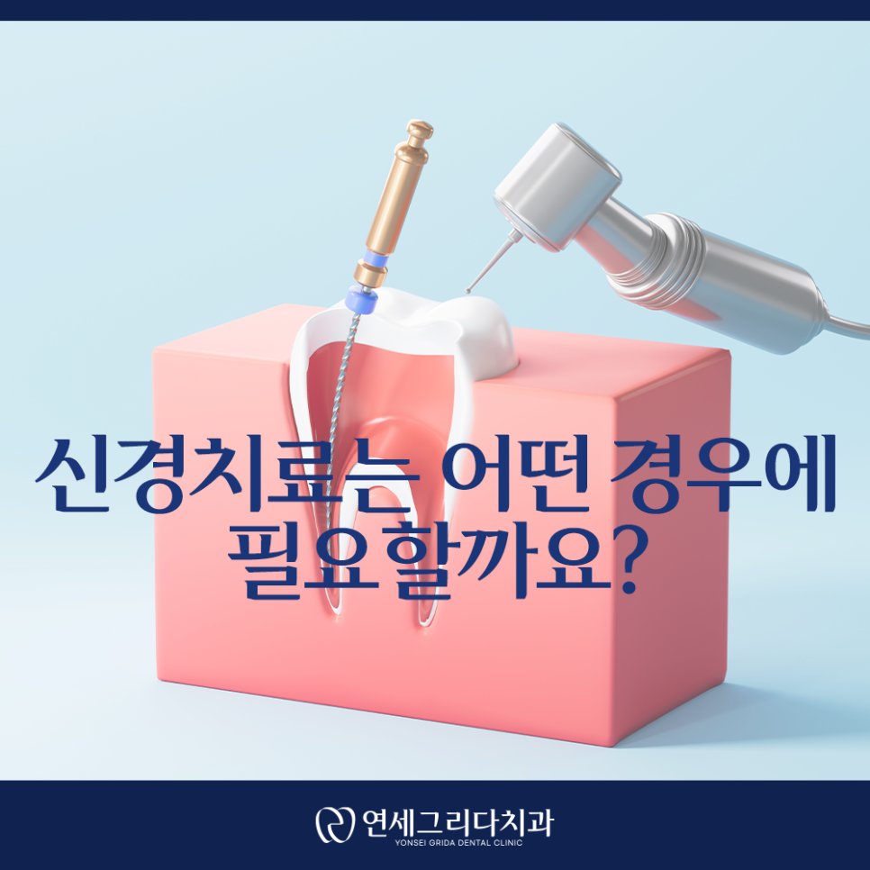 염창역신경치료, 신경치료가 필요한 치아의 신호는? 관련 이미지 4