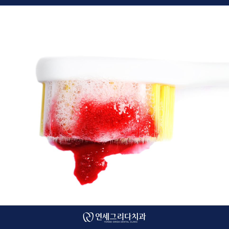 염창역잇몸치료, 양치할 때 자꾸 피가 난다면? 관련 이미지 3