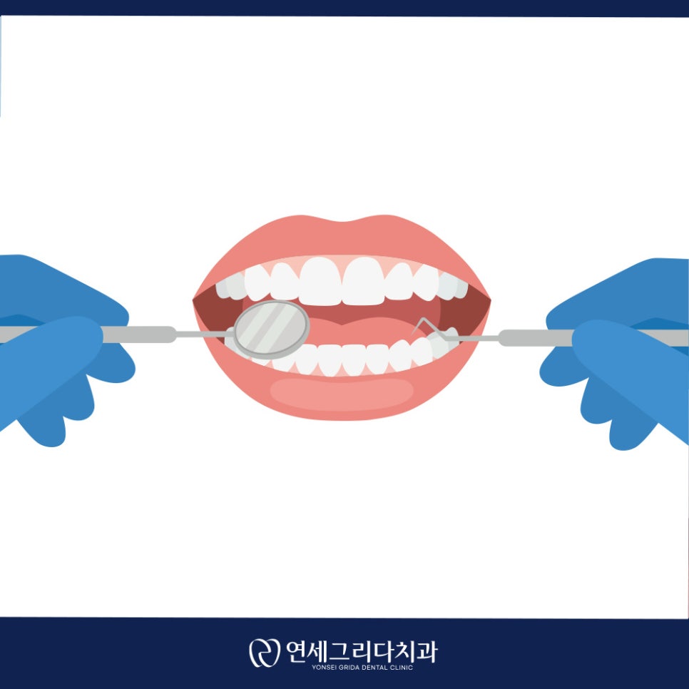 인레이 탈락 재부착이 가능할까요? 관련 이미지 7