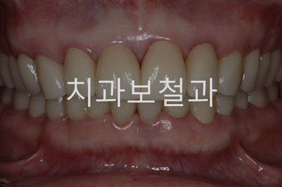 The Moment I Felt I Had Made the Right Choice in Prosthodontics image 5