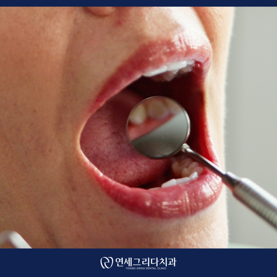 염창역치과, 임플란트 식립 후 흔들리는 느낌이 든다면? 관련 이미지 6