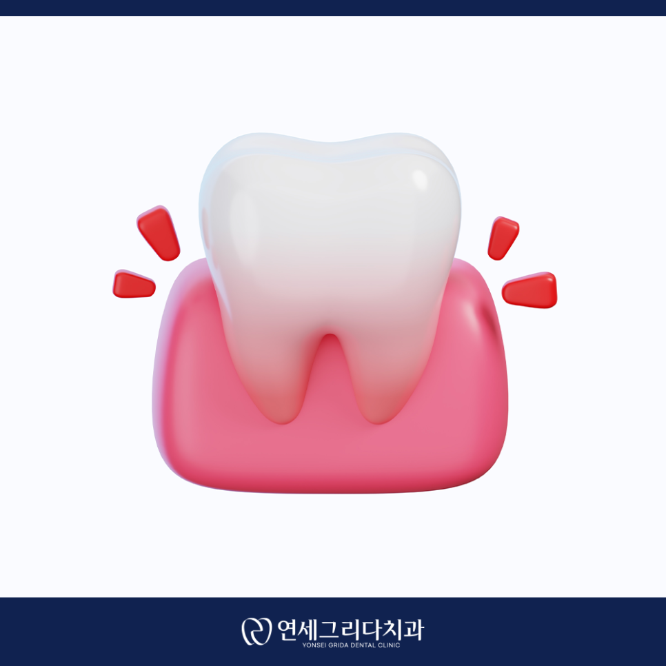 Pain After Root Canal Treatment: What If It Hurts for Several Days? image 5