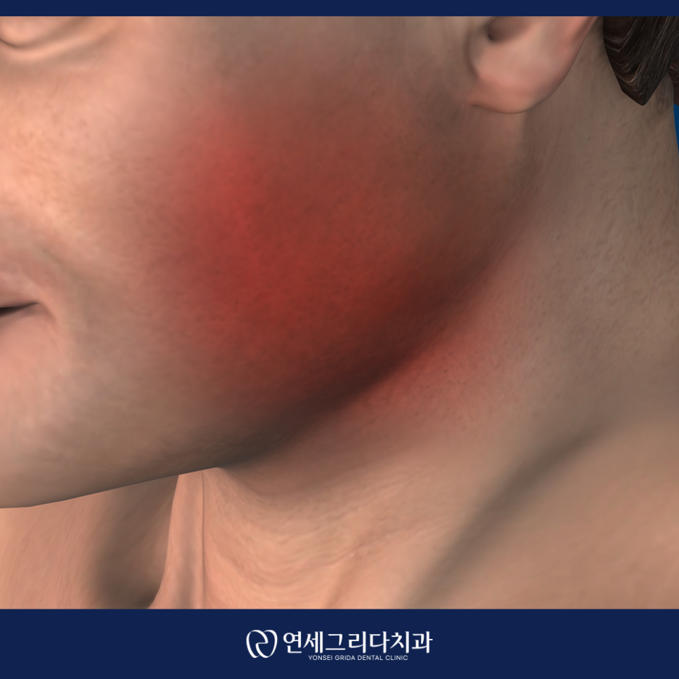 턱관절치료, 치과에서 받아야 하는 이유 관련 이미지 7