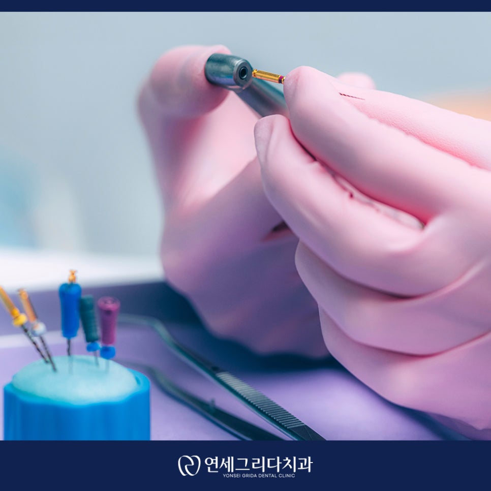 신경치료 후 보철 미루면 생기는 문제는? 관련 이미지 2