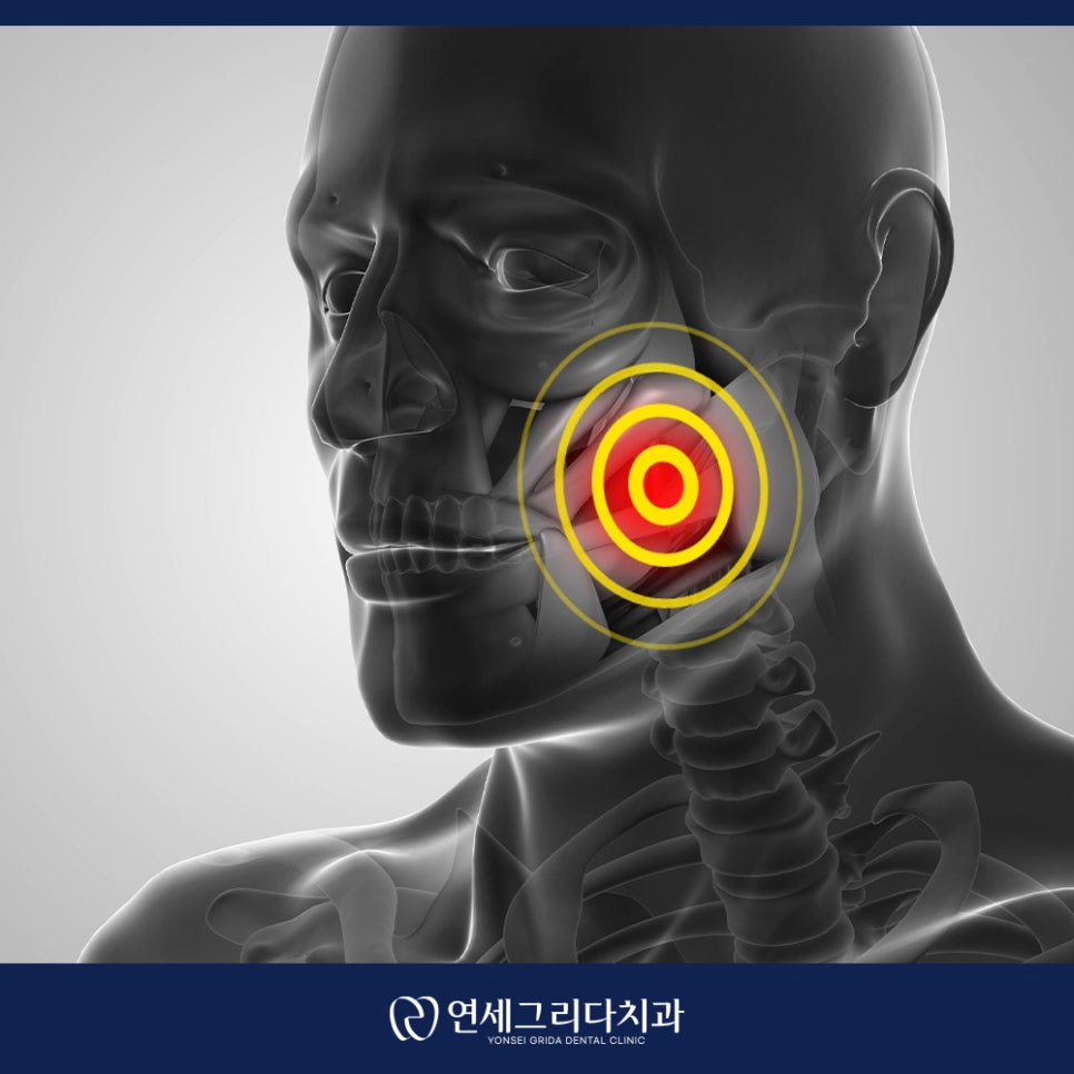 턱관절 통증 입을 벌릴 때 아픈 이유는? 관련 이미지 6
