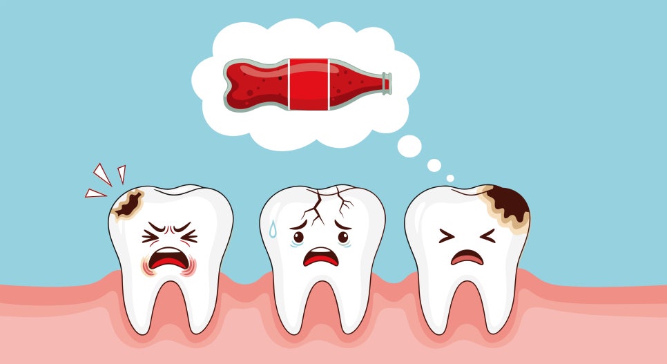 인접면 충치 조기 발견이 중요한 이유는? 관련 이미지 2