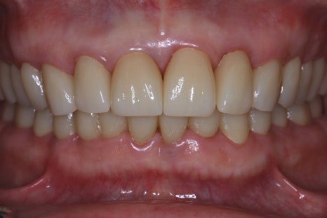 The Moment I Felt I Had Made the Right Choice in Prosthodontics image 4