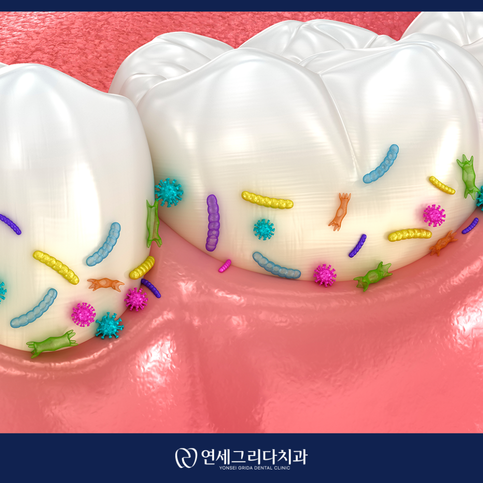 Yeomchang Station Dental Scaling: Manage It Before Tartar Builds Up image 2