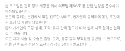 라미네이트 잘하는 곳 찾는 기준 3가지 관련 이미지 11
