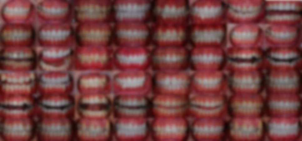 라미네이트 후회하는 2가지 이유, 그리고 다른 방법 (원진치과 원장 작성) 관련 이미지 11