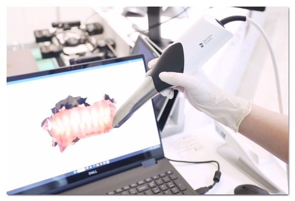 When Your Front Tooth Is Cracked, Do You Need to Visit the Dentist Immediately? (What to Check Before It Breaks) image 8