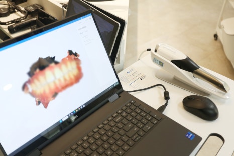 역삼동 앞니벌어짐, 브리네이트 vs 라미네이트 (의사조언) 관련 이미지 8