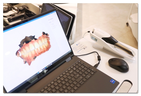 Dental Cavity Treatment Costs: Why Do Prices Differ for the Same Cavity? image 5
