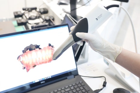 역삼동 앞니 임플란트 교체 신호 3가지 (의사작성) 관련 이미지 17