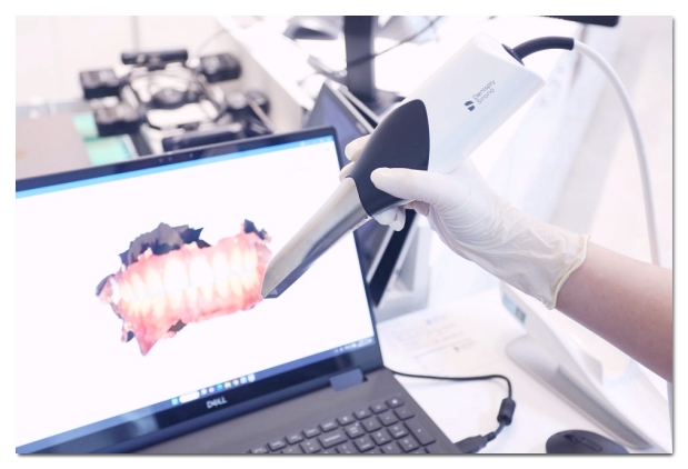 How Should You Choose a Laminate Veneer Dentist in Yeoksam-dong? image 6