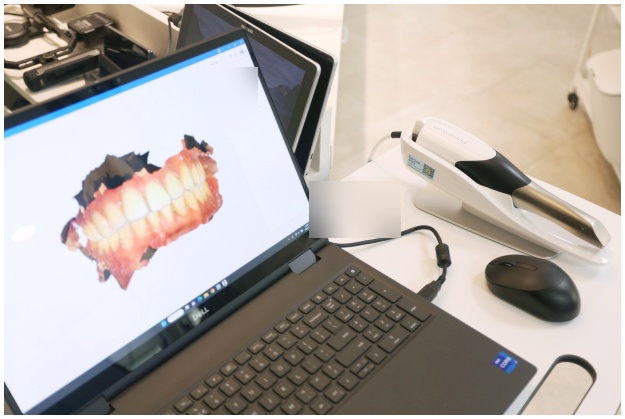 What Matters More Than Implant Prices image 9