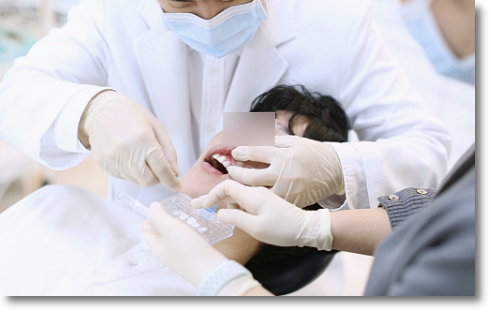 Can No-Prep Veneers Be Used on Every Tooth? image 7