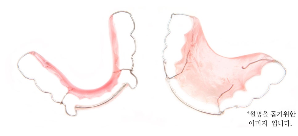 역삼동 앞니벌어짐, 브리네이트 vs 라미네이트 (의사조언) 관련 이미지 7