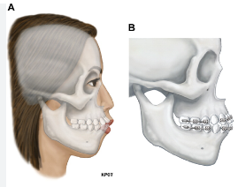 역삼동라미네이트, 결혼 앞두고 고민 중이라면? <필독> 관련 이미지 4