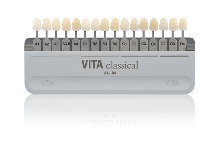 양재역 라미네이트, 과하지 않게 앞니 개선 가능한가요? 관련 이미지 11