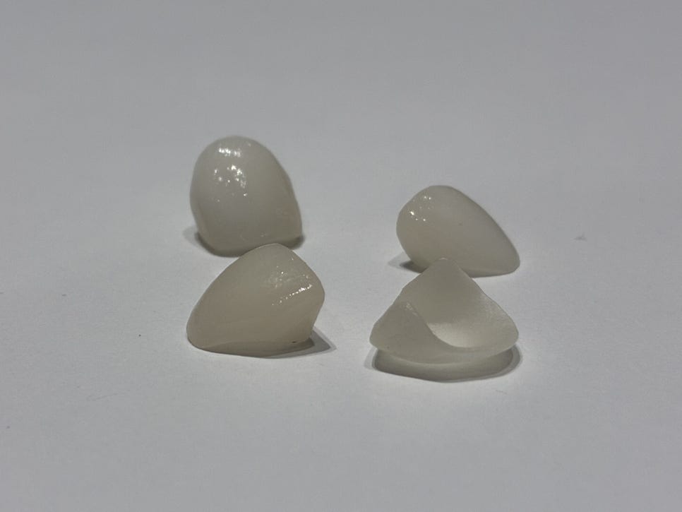 양재역 라미네이트, 과하지 않게 앞니 개선 가능한가요? 관련 이미지 7