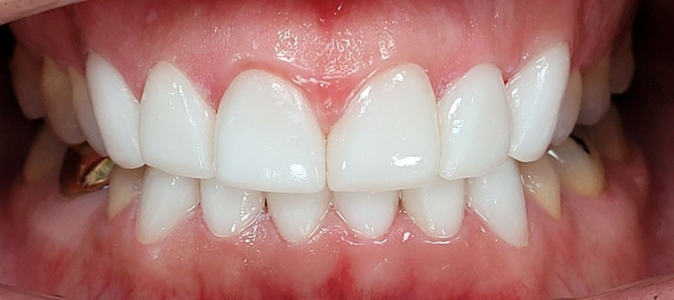 서초동 라미네이트 &lsquo;이런 분들&rsquo;께는 권하지 않습니다 <필독> 관련 이미지 15