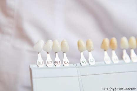 역삼동 앞니 임플란트 교체 신호 3가지 (의사작성) 관련 이미지 6