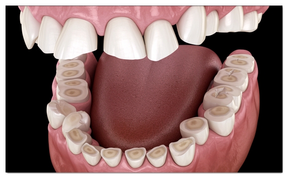 Why You Should Get TMJ Botox at a Dental Clinic image 6