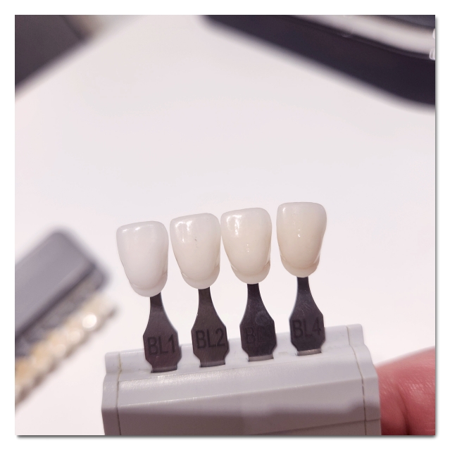 How to Choose a Good Laminate Dental Clinic Near Gangnam Station image 11