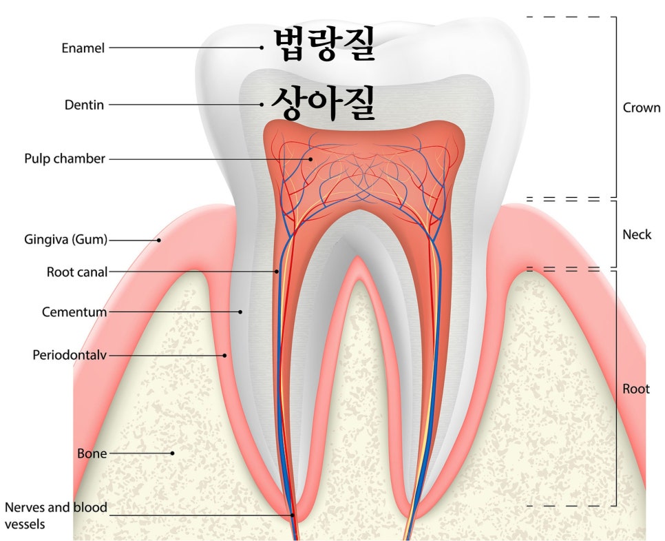 역삼동치아미백, 시작 전 이 2가지는 꼭 확인하세요 (의사작성) 관련 이미지 4