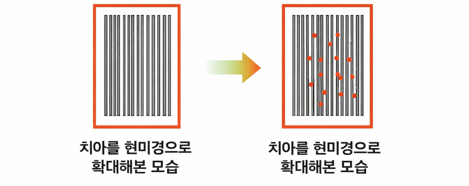 역삼동치아미백, 시작 전 이 2가지는 꼭 확인하세요 (의사작성) 관련 이미지 10