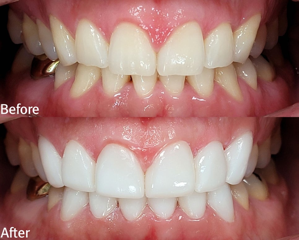 서초동 라미네이트 &lsquo;이런 분들&rsquo;께는 권하지 않습니다 <필독> 관련 이미지 16