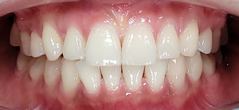 역삼동라미네이트, 결혼 앞두고 고민 중이라면? <필독> 관련 이미지 11