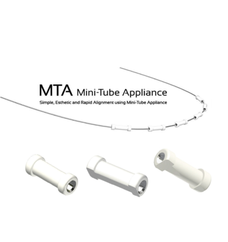 역삼동 앞니벌어짐, 브리네이트 vs 라미네이트 (의사조언) 관련 이미지 5